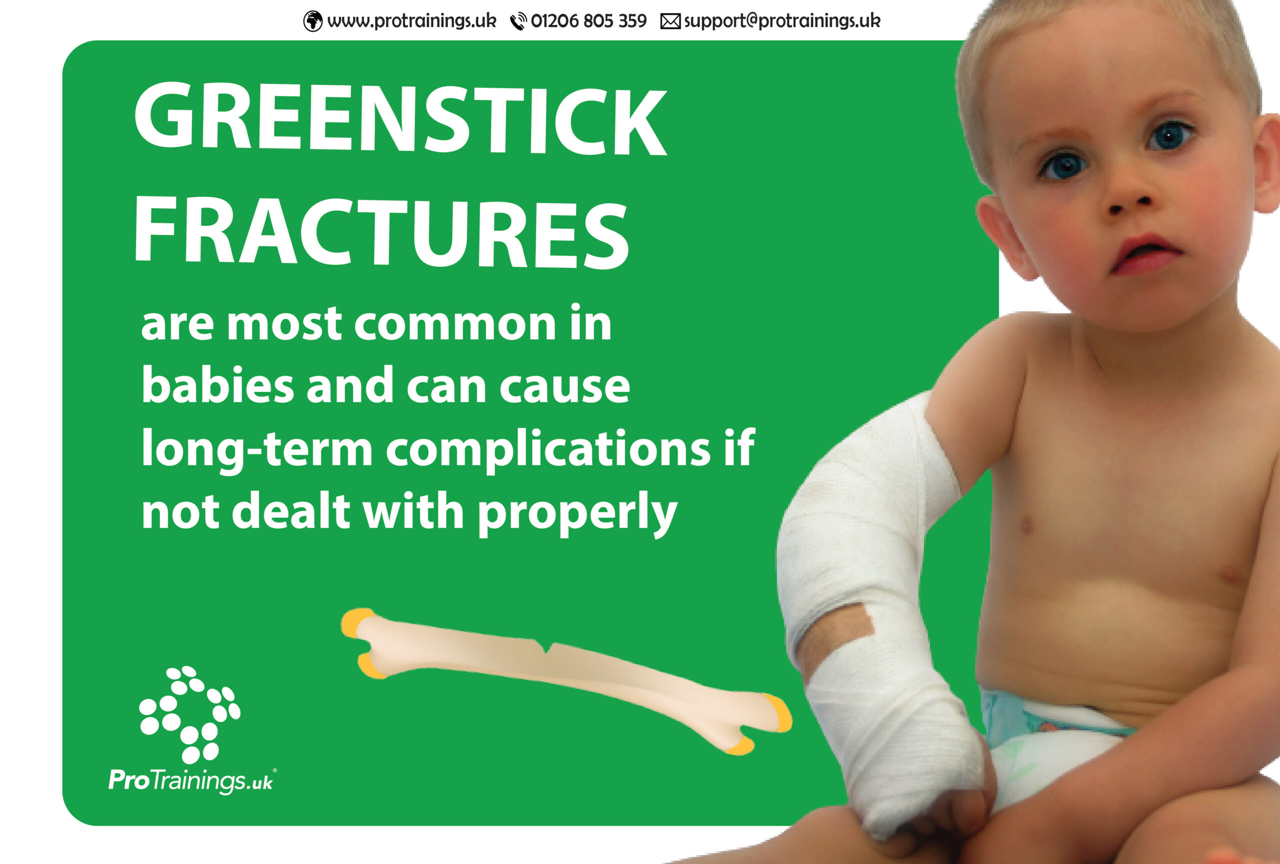 greenstick-fractures