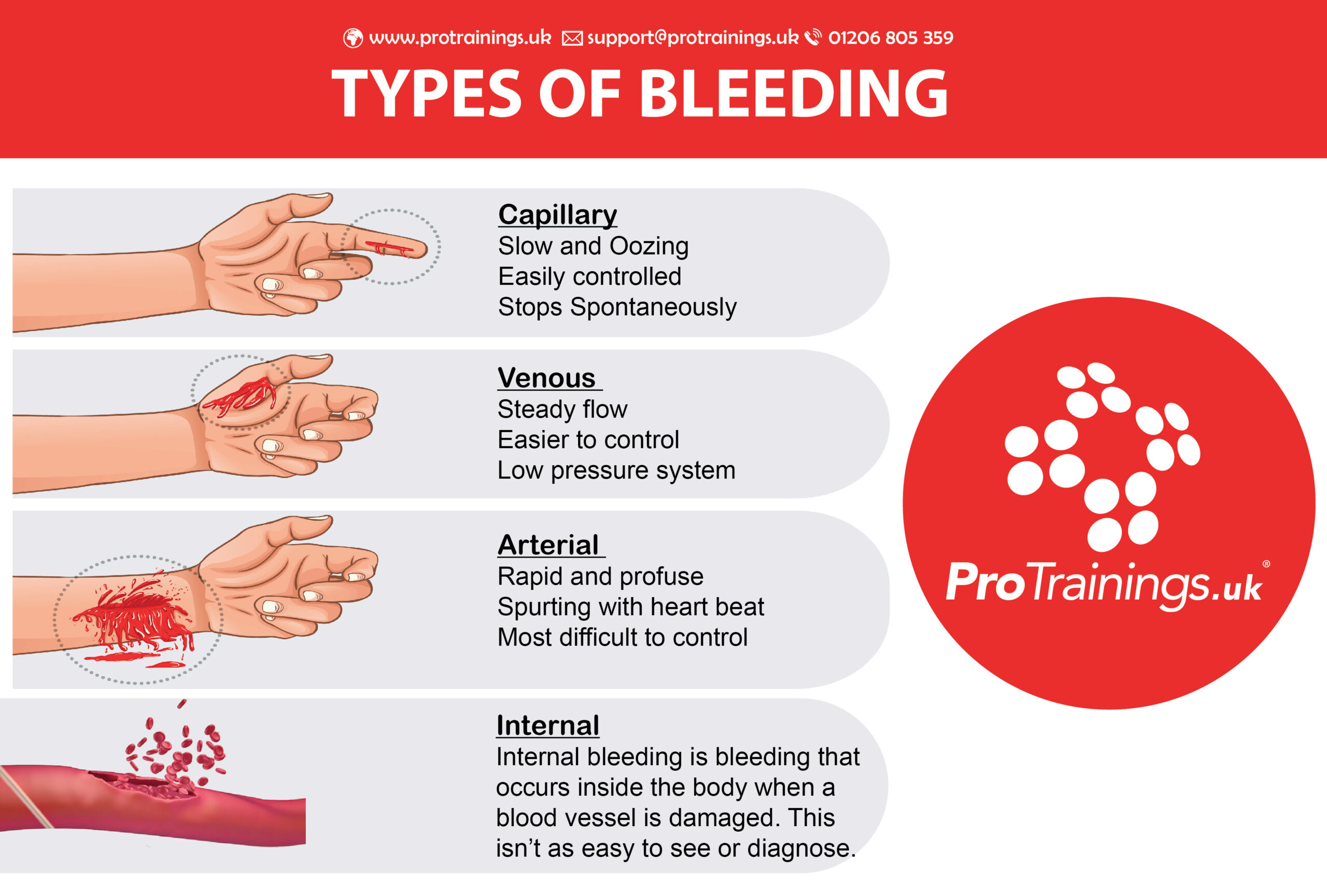 What Are The Main Types Of Bleeding 